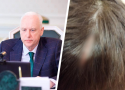 Глава Следкома РФ заинтересовался делом об избиении мальчика после публикации «Блокнота Ставрополь» 