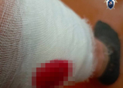 Нападение стаи собак на женщину в Минводах стало поводом для уголовного дела