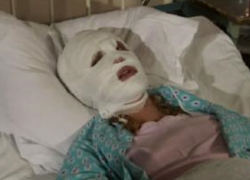 Состояние облитых кислотой девочек в Буденновске оценивается врачами как тяжелое, - источник