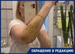 «Нечего было махать руками»: жительниц Ставрополя покусала собака без поводка и намордника