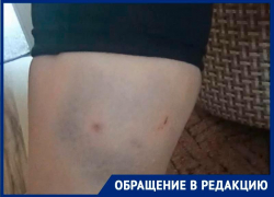 «Плачу от испуга»: бродячие собаки напали на жительницу Светлограда на Ставрополье 