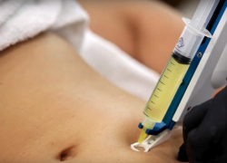 «Укол красоты» в частной клинике стоил пятигорчанке жизни