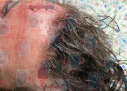 Пьяная драка в ночном клубе Ставрополя вылилась в тяжелую травму головы 