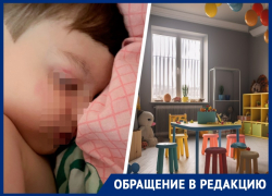 Пришедший из частного детсада с синяками ребенок в Ставрополе спровоцировал конфликт родителей и воспитателей 