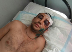 Молодого отца троих детей избили толпой в Лермонтове