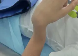 Врачи показали на видео, что стало с подростком-электросамокатчиком в Пятигорске