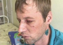 Молодую семью зверски избили из-за замечания не кричать ночью под окнами в Ставрополе 