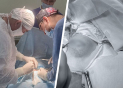 Кисту размером с яблоко удалили подростку хирурги в Пятигорске