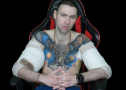 Конец Терешина? Финальная операция и риск ампутации грозят синтоловому качку из Пятигорска Руки Базуки