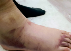 Мама отсудила 50 тысяч у сельской школы на Ставрополье: все из-за урока физкультуры 