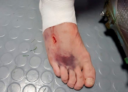 Ставрополец Кутепов отыграл матч с Хорватией с серьезной травмой ноги