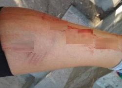 Бездомная собака укусила женщину в центре Кисловодска