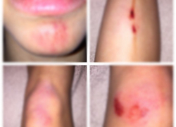 На велодорожке в Ставрополе из-за пешеходов пострадала девушка