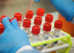 Коронавирусная инфекция подтвердилась у еще 93 ставропольцев