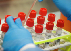 На Ставрополье у еще 10 человек подтвердился коронавирус