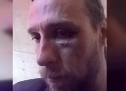 "Будешь знать, как язык распускать": известного журналиста избили в центре Ставрополя