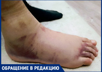 «Нога была черная и раздувалась все больше»: мама обвинила руководство школы в бессердечности на Ставрополье