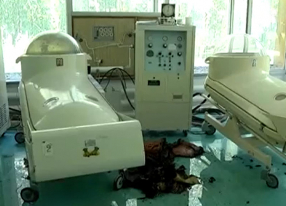 Ожоги покрыли почти все тело. Прошло 14 лет со дня гибели подростка после трагедии в барокамере в Ставрополе