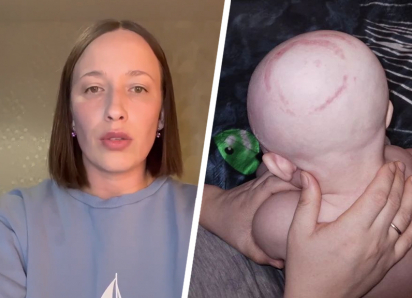 Сломали череп и ключицу: запрещенные методы при родах в ставропольском перинатальном центре окончились травмами младенца