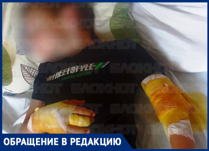 «Руки прокусаны насквозь»: после нападения агрессивного ротвейлера ребенок попал в больницу на Ставрополье