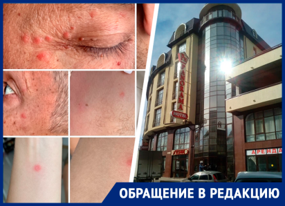 «Отдых превратился в бытовой кошмар»: семья пожаловалась на клопов в гостинице Кисловодска