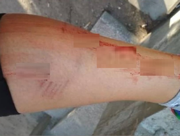 Бездомная собака укусила женщину в центре Кисловодска