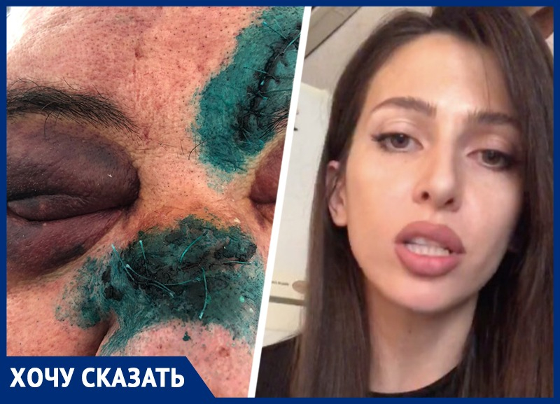 «Теперь можешь его убивать»: ставропольчанка рассказала о жестоком избиении отца соседями