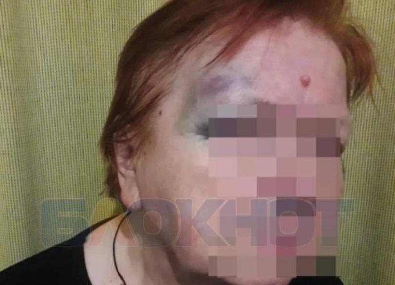 Полиция разбирается в деле об избиении пенсионерки таксистом в Ставрополе