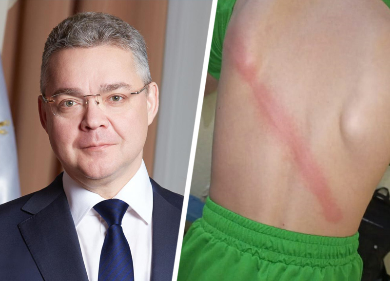 Есть вещи, которые должны оставаться в прошлом ― губернатор Ставрополья об избиении 12-летнего кадета плетью