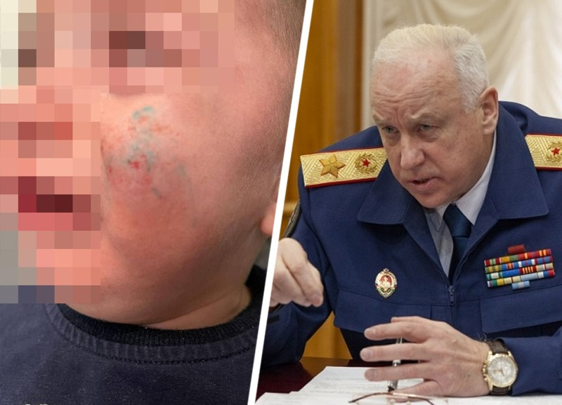 Глава следкома РФ Бастрыкин поручил провести проверку по нападению собак на женщину с ребенком в Минводах