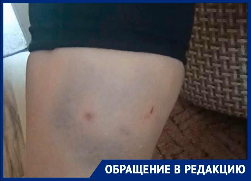«Плачу от испуга»: бродячие собаки напали на жительницу Светлограда на Ставрополье