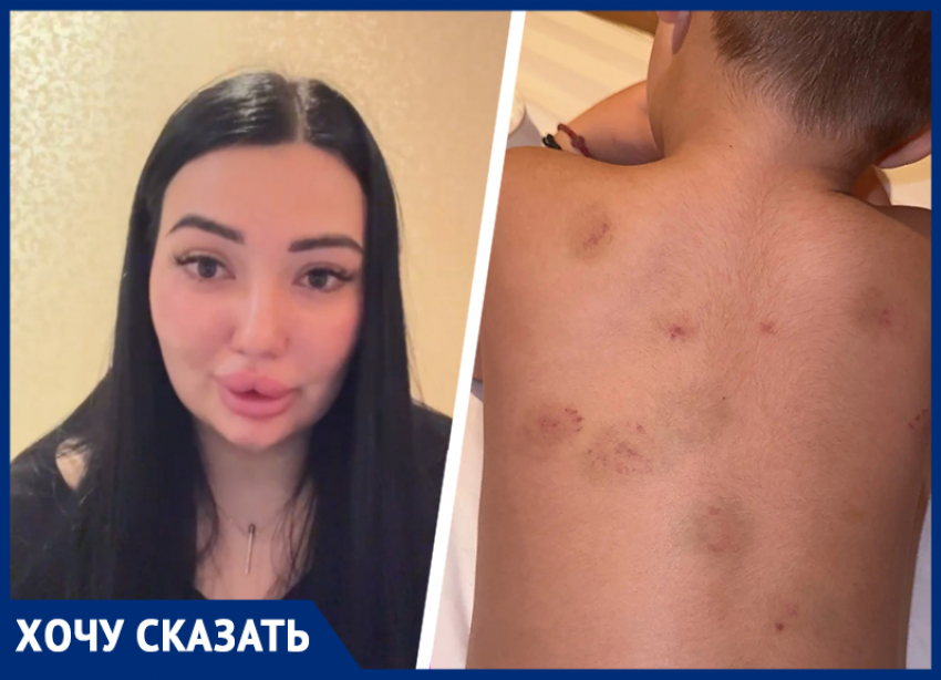 Кусали дети, но виноваты взрослые: мама травмированного в детсаду ребенка обратилась к губернатору Ставрополья