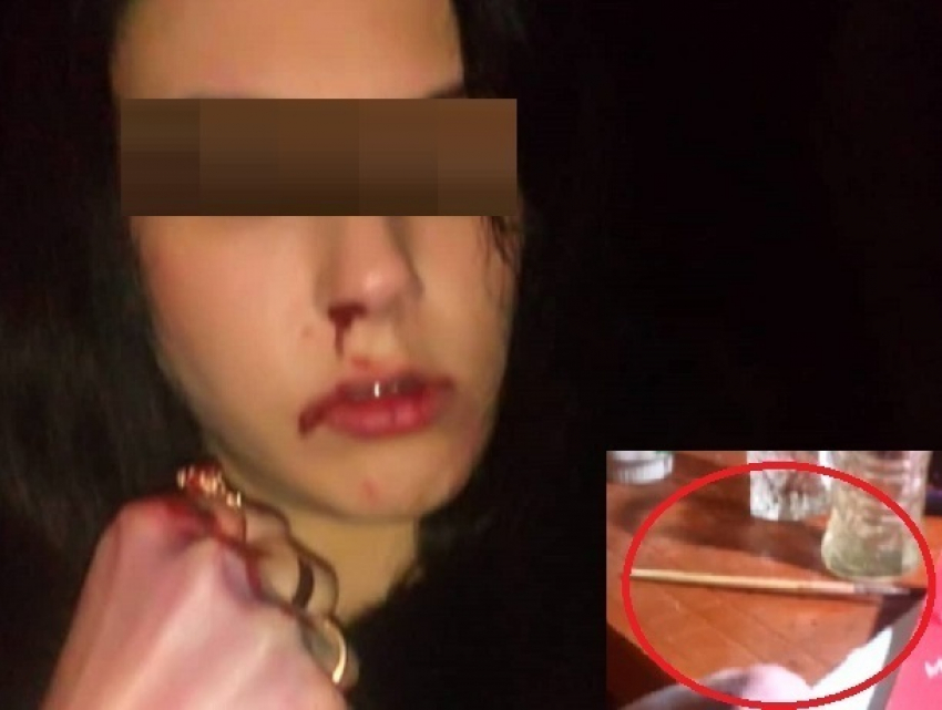 "А на столе кисточка": в кровавое избиение девушки тремя парнями не поверили жители Кисловодска