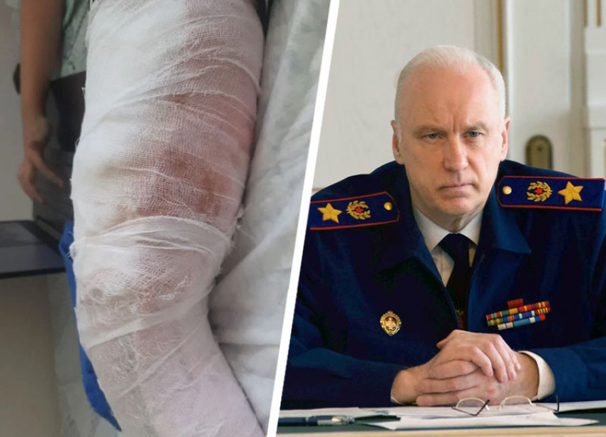 Бастрыкин потребовал возбудить дело после нападения собаки на ребенка в Ставропольском крае