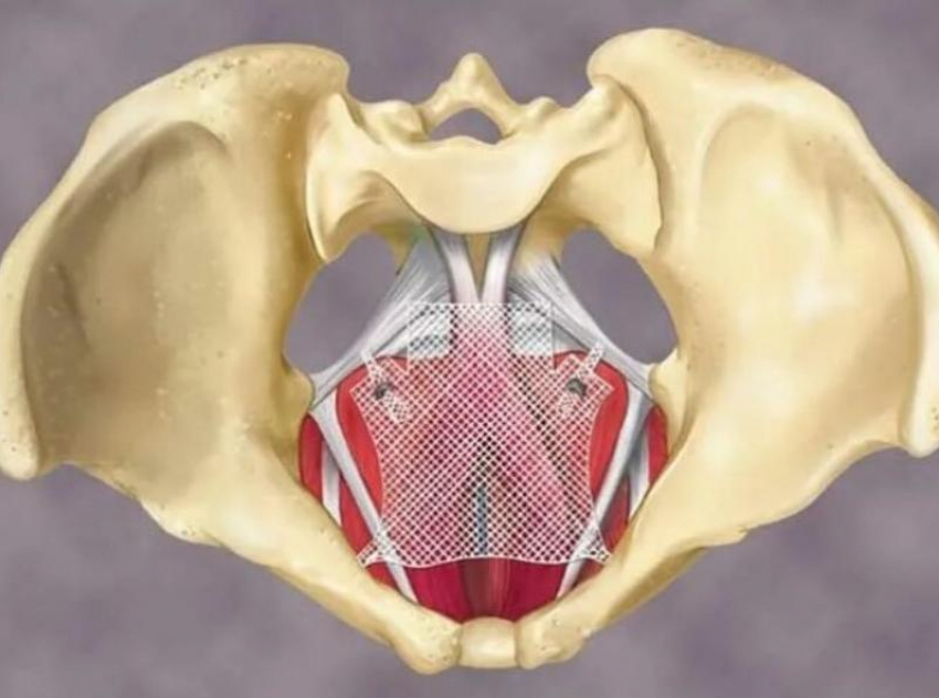 Четыре сложные операции по восстановлению тазового дна впервые провели в Ставрополе