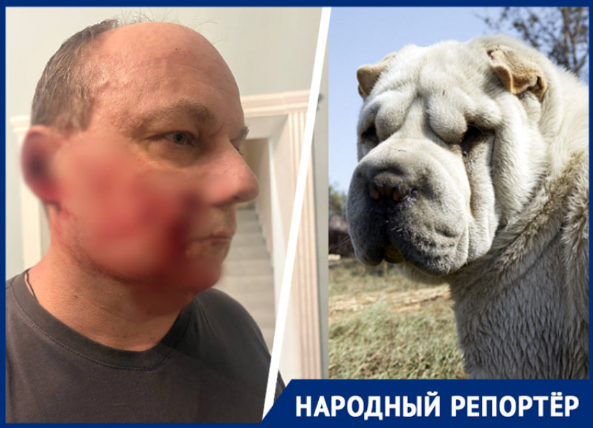 «Я прижался к калитке и стал стучать»: собака напала на ставропольца и покусала лицо