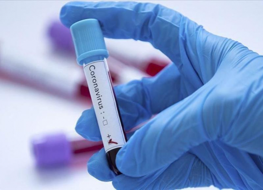 Российские ученые планируют тестировать людей на иммунитет к коронавирусу