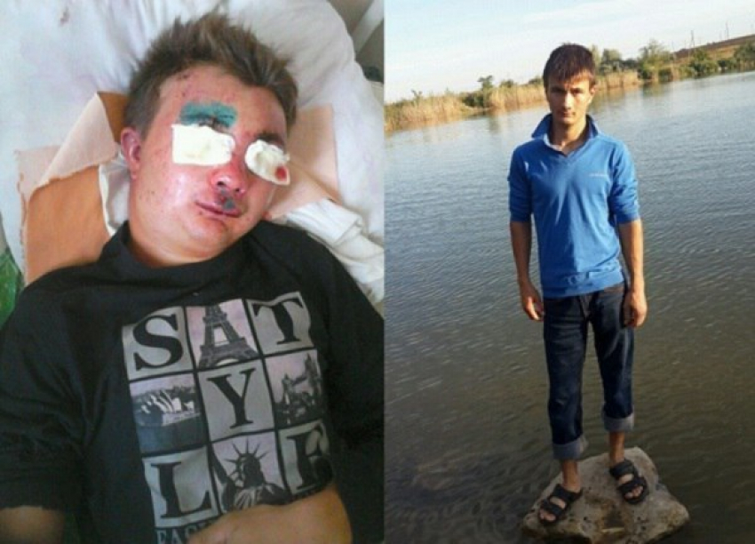 На Ставрополье парень впал в кому после массового избиения