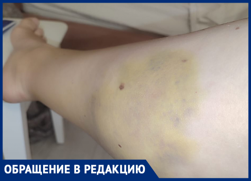 Ужасная боль и шок: беременная ставропольчанка рассказала о ДТП без виновных