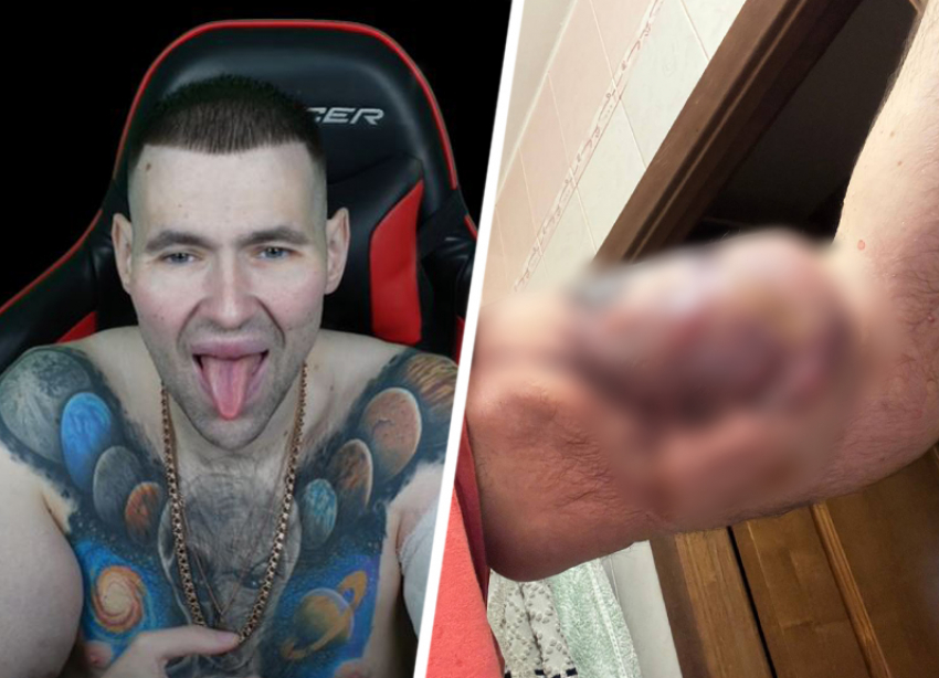 «Прости меня, Боженька»: фрик-блогер из Пятигорска Руки Базуки перенес очередную операцию