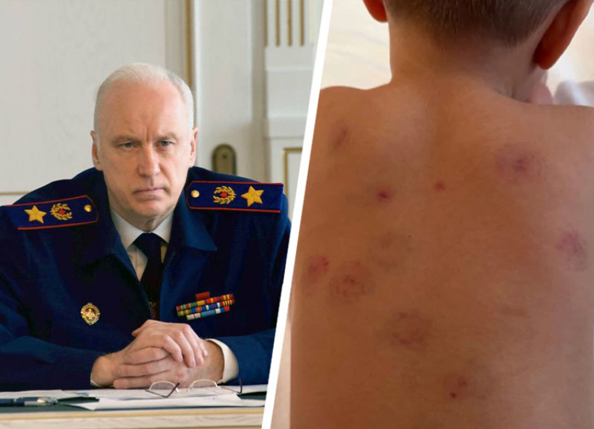 Бастрыкин запросил доклад после травмирования ребенка в детсаду Минеральных Вод