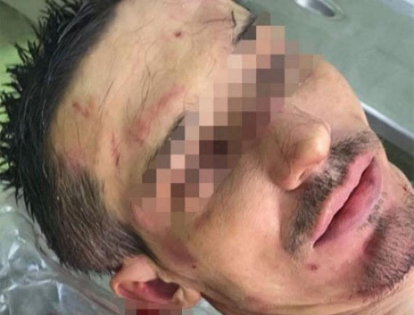 Садистам из пятигорского рехаба с бесчеловечными пытками назначили наказание