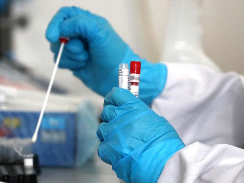 На Ставрополье 295 больных коронавирусом находятся под аппаратами ИВЛ