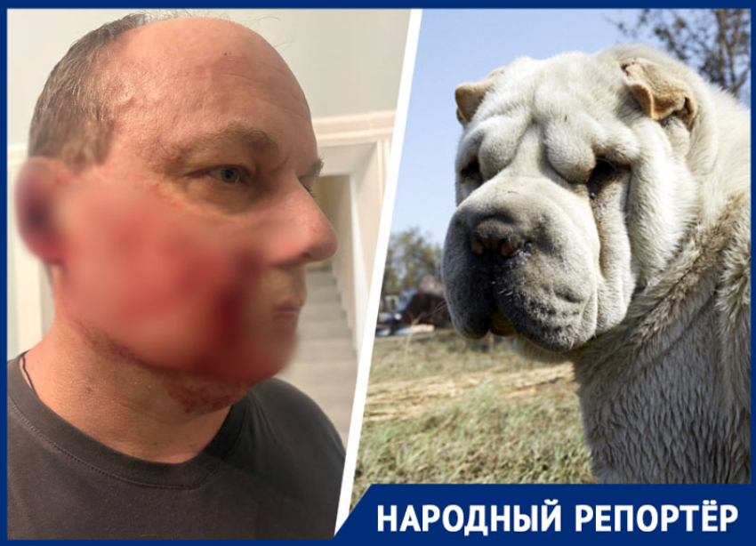 «Я прижался к калитке и стал стучать»: собака напала на ставропольца и покусала лицо