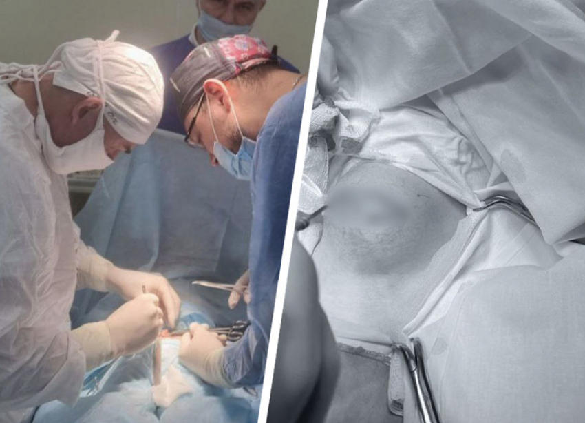 Кисту размером с яблоко удалили подростку хирурги в Пятигорске