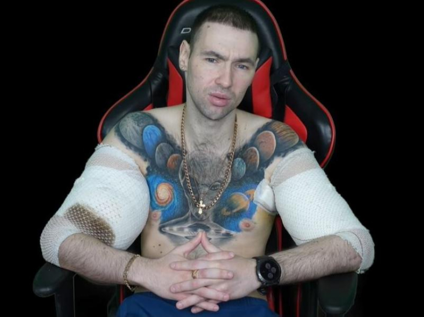 Конец Терешина? Финальная операция и риск ампутации грозят синтоловому качку из Пятигорска Руки Базуки