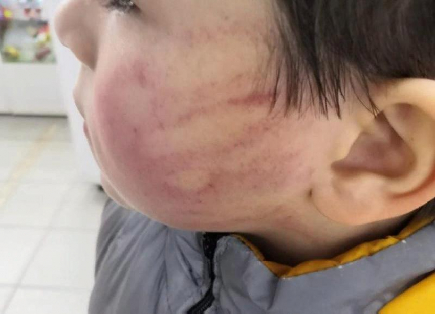 В отношении ударившей ребенка ставропольской воспитательницы возбудили уголовное дело