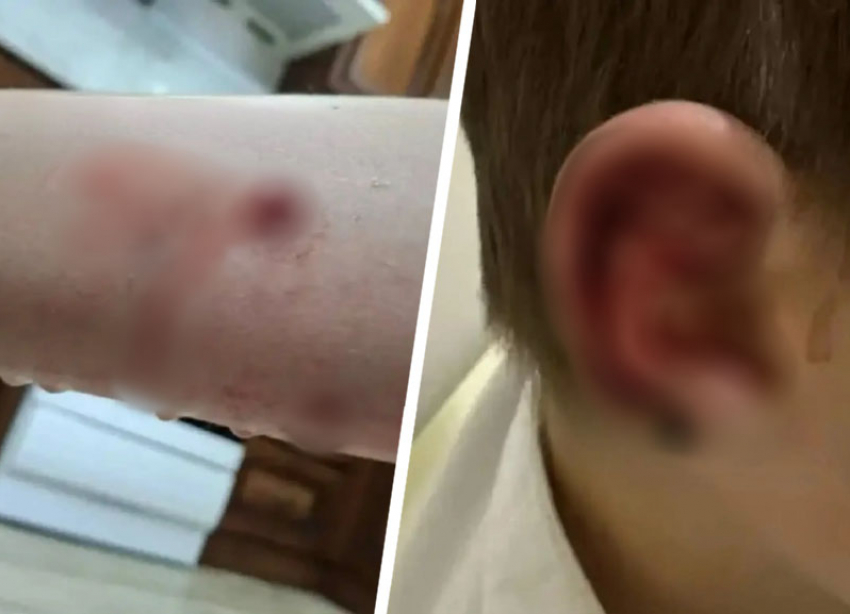 Нападение собак на детей в Минеральных Водах обернулось уголовным делом 