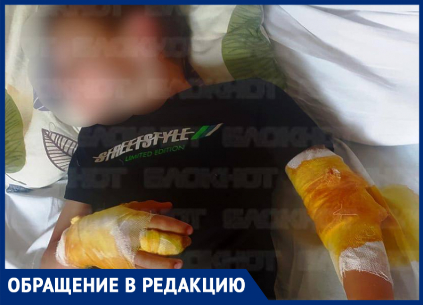 «Руки прокусаны насквозь»: после нападения агрессивного ротвейлера ребенок попал в больницу на Ставрополье