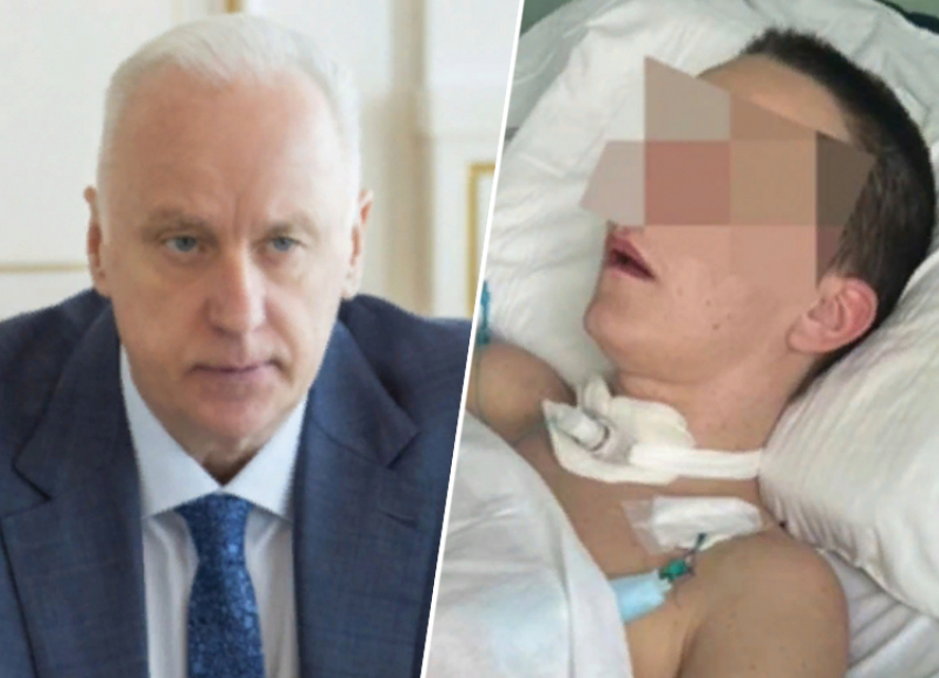 Бастрыкин заинтересовался уголовным делом из-за комы после пластической операции в Пятигорске